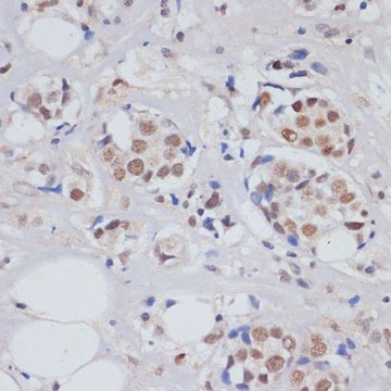 Anti-SKIV2L2 antibody produced in rabbit