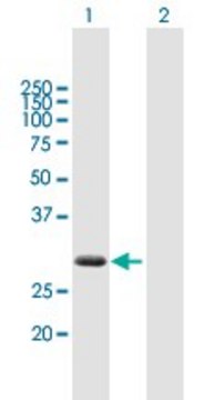 抗-ZBED2 小鼠抗 purified immunoglobulin, buffered aqueous solution