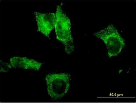 Monoclonal Anti-CEL antibody produced in mouse clone 3C8, purified immunoglobulin, buffered aqueous solution