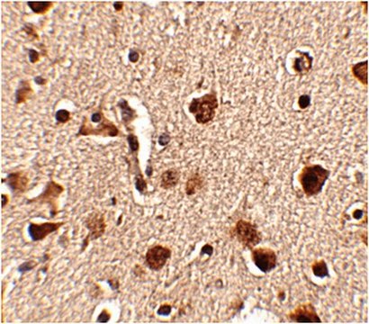 Anti-Slitrk4 Antibody from rabbit, purified by affinity chromatography