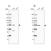 Anti-HGD antibody produced in rabbit Prestige Antibodies® Powered by Atlas Antibodies, affinity isolated antibody, buffered aqueous glycerol solution