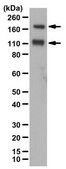 Anti-IGF-IR&#945; subunit Antibody from chicken, purified by affinity chromatography