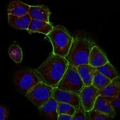 Anti-Ras Antibody, clone RAS10, Alexa Fluor™ 555 Conjugate clone RAS10, from mouse, ALEXA FLUOR™ 555