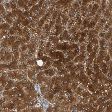 Anti-PARP14 antibody produced in rabbit Prestige Antibodies&#174; Powered by Atlas Antibodies, affinity isolated antibody, buffered aqueous glycerol solution