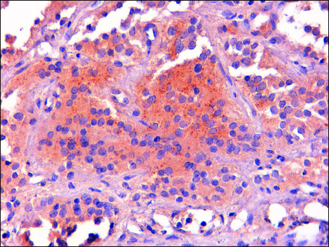 Anti-Proopiomelanocortin/POMC antibody produced in goat affinity isolated antibody, buffered aqueous solution