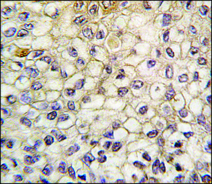 Anti-CYP2F1 (C-term) antibody produced in rabbit saturated ammonium sulfate (SAS) precipitated, buffered aqueous solution