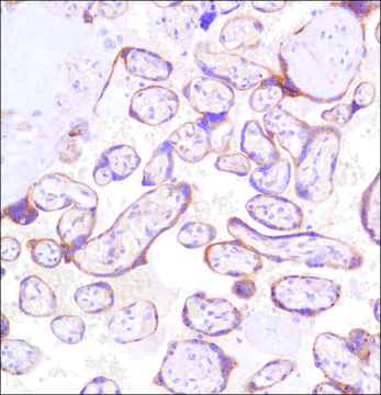 Anti-Glypican-3 antibody, Rabbit monoclonal clone SP86, recombinant, expressed in proprietary host, affinity isolated antibody