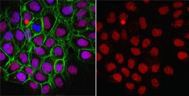 Anti-Thymine-DNA Glycosylase Antibody from rabbit, purified by affinity chromatography