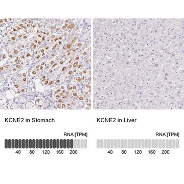 Anti-KCNE2 antibody produced in rabbit Prestige Antibodies® Powered by Atlas Antibodies, affinity isolated antibody, buffered aqueous glycerol solution