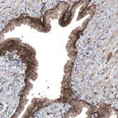 Anti-C19orf66 antibody produced in rabbit Prestige Antibodies® Powered by Atlas Antibodies, affinity isolated antibody, buffered aqueous glycerol solution