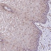 Anti-POLR2I antibody produced in rabbit Prestige Antibodies® Powered by Atlas Antibodies, affinity isolated antibody, buffered aqueous glycerol solution