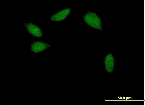 Anti-HNF1B antibody produced in mouse purified immunoglobulin, buffered aqueous solution