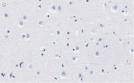 Anti-PEA15 Antibody, clone 2J13 ZooMAb® Rabbit Monoclonal recombinant, expressed in HEK 293 cells