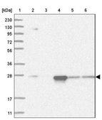 Anti-PSMA5 antibody produced in rabbit Prestige Antibodies® Powered by Atlas Antibodies, affinity isolated antibody, buffered aqueous glycerol solution, ab3