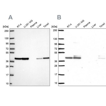 Anti-STRAP antibody produced in rabbit Prestige Antibodies&#174; Powered by Atlas Antibodies, affinity isolated antibody