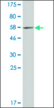 Monoclonal Anti-PECR antibody produced in mouse clone 2F10, ascites fluid