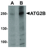 Anti-ATG2B antibody produced in rabbit affinity isolated antibody