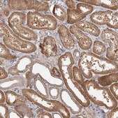 Anti-DHRS9 antibody produced in rabbit Prestige Antibodies® Powered by Atlas Antibodies, affinity isolated antibody, buffered aqueous glycerol solution