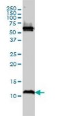 Monoclonal Anti-ATPIF1 antibody produced in mouse clone 3E2, purified immunoglobulin, buffered aqueous solution