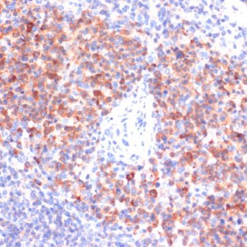 Anti-Phospho-NF-kB p65-S311 antibody produced in rabbit