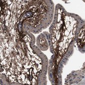 Anti-COL6A2 antibody produced in rabbit affinity isolated antibody, buffered aqueous glycerol solution