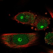 Anti-GNL3L antibody produced in rabbit Prestige Antibodies® Powered by Atlas Antibodies, affinity isolated antibody, buffered aqueous glycerol solution
