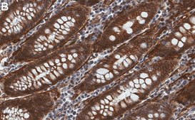 Anti-γ Catenin Antibody, clone 1H22 ZooMAb® Rabbit Monoclonal recombinant, expressed in HEK 293 cells