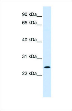 Anti-NOL3 antibody produced in rabbit affinity isolated antibody