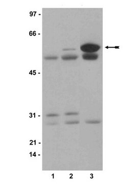 Anti-phospho-Src (Tyr416) Antibody, clone 9A6 clone 9A6, Upstate&#174;, from mouse