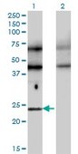 Monoclonal Anti-TFEC, (N-terminal) antibody produced in mouse clone 4F11, purified immunoglobulin, buffered aqueous solution