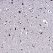 Anti-C19orf47 antibody produced in rabbit Prestige Antibodies® Powered by Atlas Antibodies, affinity isolated antibody, buffered aqueous glycerol solution