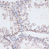 Anti-Phospho-MAPK3-Y204 antibody produced in rabbit