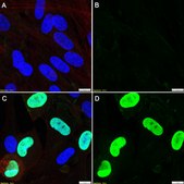 Anti-CMV immediate early Antibody, clone 6F8.2 ZooMAb® Mouse Monoclonal recombinant, expressed in HEK 293 cells