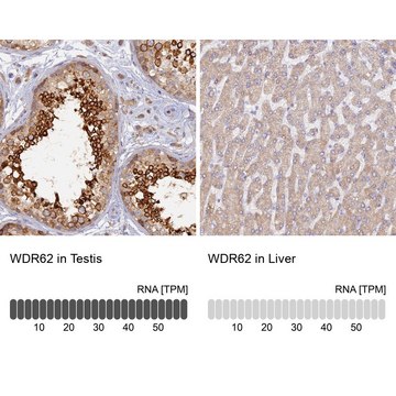 Anti-WDR62 antibody produced in rabbit Prestige Antibodies&#174; Powered by Atlas Antibodies, affinity isolated antibody, buffered aqueous glycerol solution