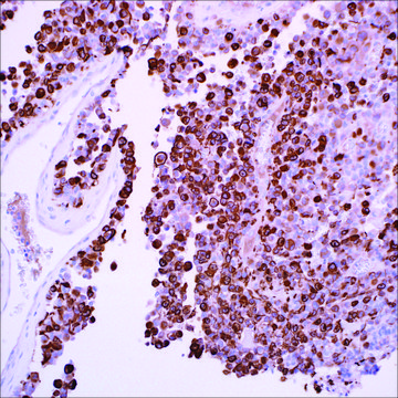 Neurofilament (EP79) Rabbit Monoclonal Primary Antibody