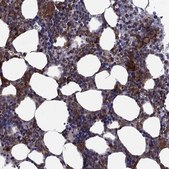 Anti-PLCB2 antibody produced in rabbit Prestige Antibodies® Powered by Atlas Antibodies, affinity isolated antibody, buffered aqueous glycerol solution