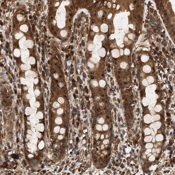 Anti-SH3GLB2 antibody produced in rabbit Prestige Antibodies&#174; Powered by Atlas Antibodies, affinity isolated antibody, buffered aqueous glycerol solution, Ab1