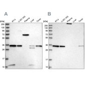 Anti-VPS37B antibody produced in rabbit Prestige Antibodies® Powered by Atlas Antibodies, affinity isolated antibody, buffered aqueous glycerol solution