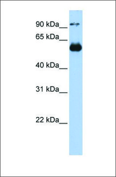 Anti-ETS2 (ab1) antibody produced in rabbit affinity isolated antibody