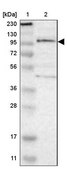 抗-TSHZ1 兔抗 Prestige Antibodies® Powered by Atlas Antibodies, affinity isolated antibody, buffered aqueous glycerol solution