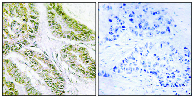 Anti-BAX antibody produced in rabbit affinity isolated antibody