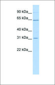 Anti-SLC27A2 antibody produced in rabbit affinity isolated antibody