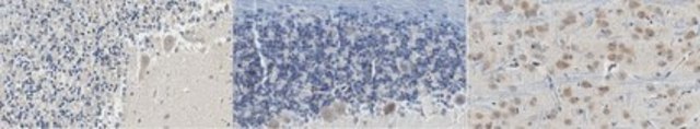 Anti-PSD95 Antibody, clone 3H4.3 clone 3H4.3, from mouse