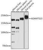 Anti-ADAMTS13 Antibody, clone 7B2Z8, Rabbit Monoclonal