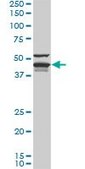 Monoclonal Anti-DNAJA4 antibody produced in mouse clone 4B4-1F2, purified immunoglobulin, buffered aqueous solution