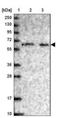 Anti-PHF8 antibody produced in rabbit Prestige Antibodies® Powered by Atlas Antibodies, affinity isolated antibody, buffered aqueous glycerol solution