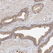 Anti-OFD1 antibody produced in rabbit Prestige Antibodies® Powered by Atlas Antibodies, affinity isolated antibody, buffered aqueous glycerol solution