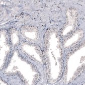 Monoclonal Anti-NIFK antibody produced in mouse Prestige Antibodies® Powered by Atlas Antibodies, clone CL2240, purified immunoglobulin, buffered aqueous glycerol solution