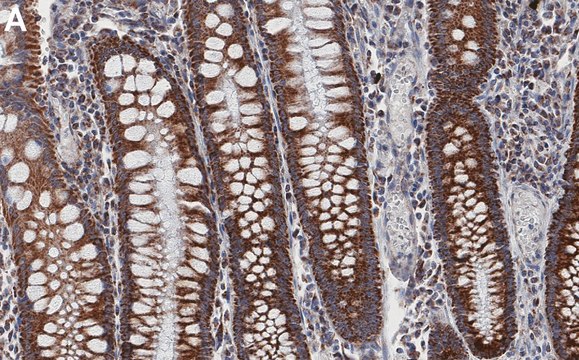 Anti-TOMM20 Antibody, clone 2F8.1 ZooMAb&#174; Mouse Monoclonal recombinant, expressed in HEK 293 cells