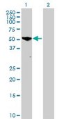 Anti-PGM5 antibody produced in mouse IgG fraction of antiserum, buffered aqueous solution